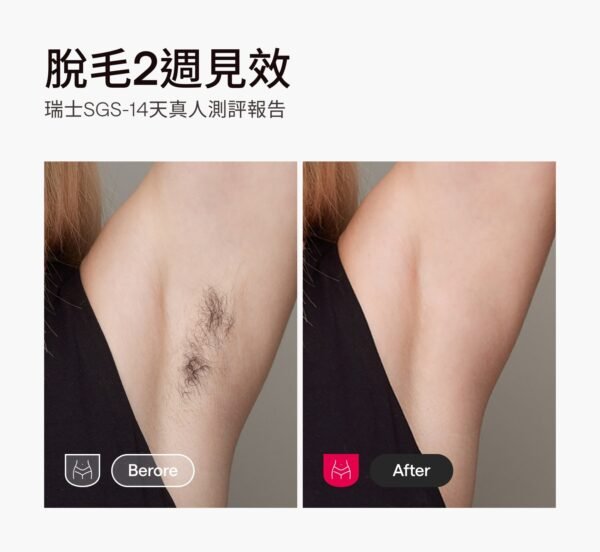 06-_-pink_3a6abb2f-df1e-4e15-a5de-b969064aaf4e.jpg Ulike Air10 Home Hair Removal Device