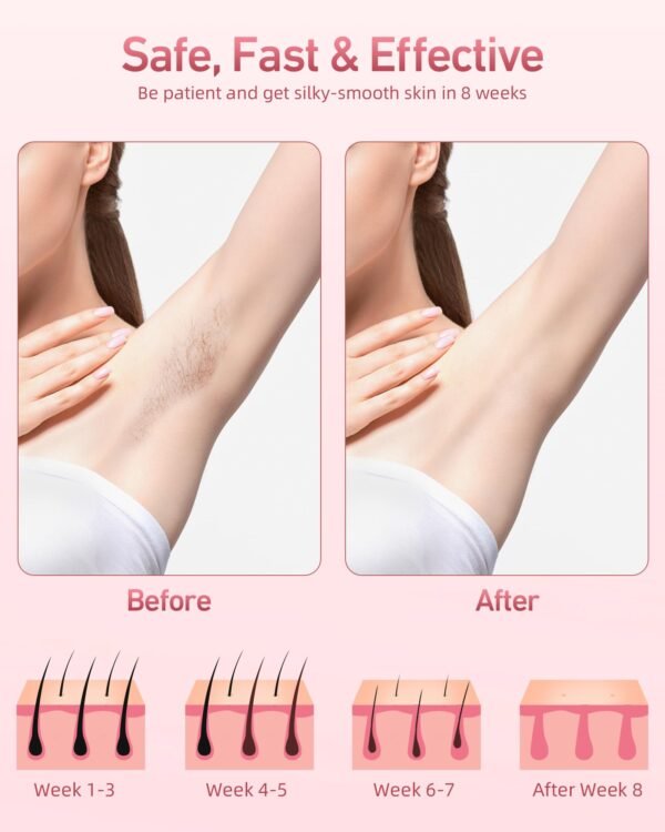 IPL Laser Hair Removal（T15）